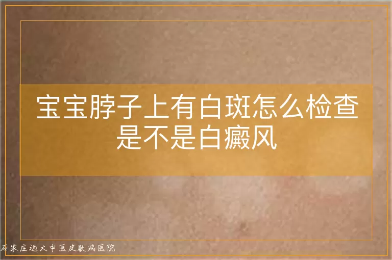 宝宝脖子上有白斑怎么检查是不是白癜风