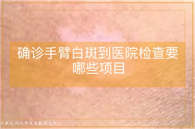 确诊手臂白斑到医院检查要哪些项目