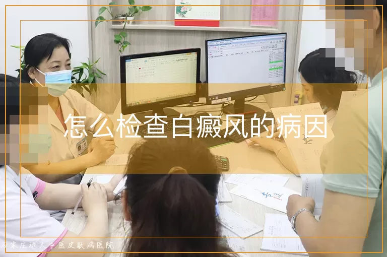 怎么检查白癜风的病因