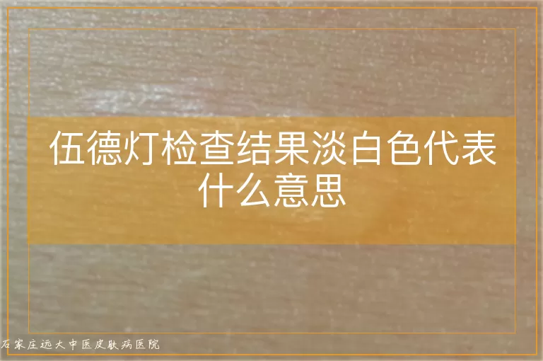 伍德灯检查结果淡白色代表什么意思