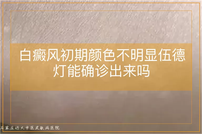 白癜风初期颜色不明显伍德灯能确诊出来吗