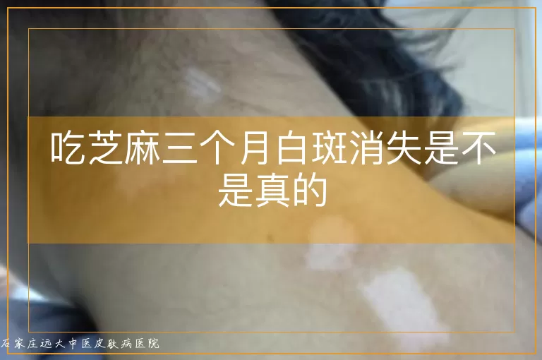 吃芝麻三个月白斑消失是不是真的