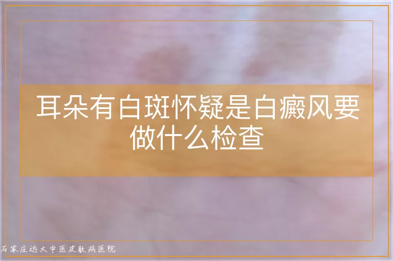 耳朵有白斑怀疑是白癜风要做什么检查