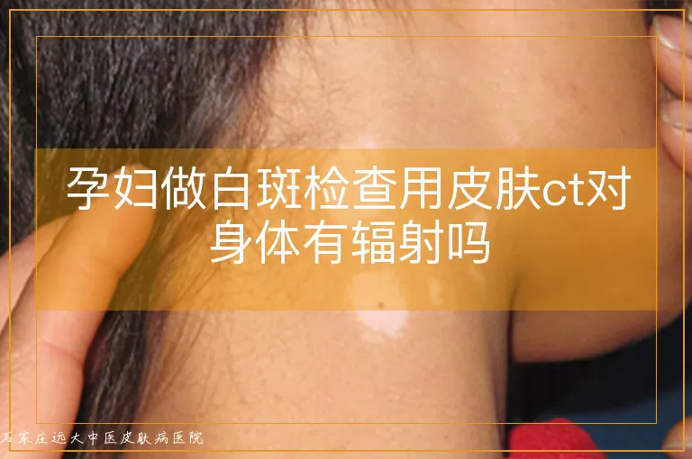 孕妇做白斑检查用皮肤ct对身体有辐射吗