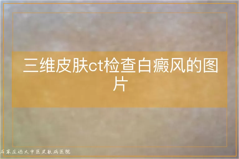 三维皮肤ct检查白癜风的图片