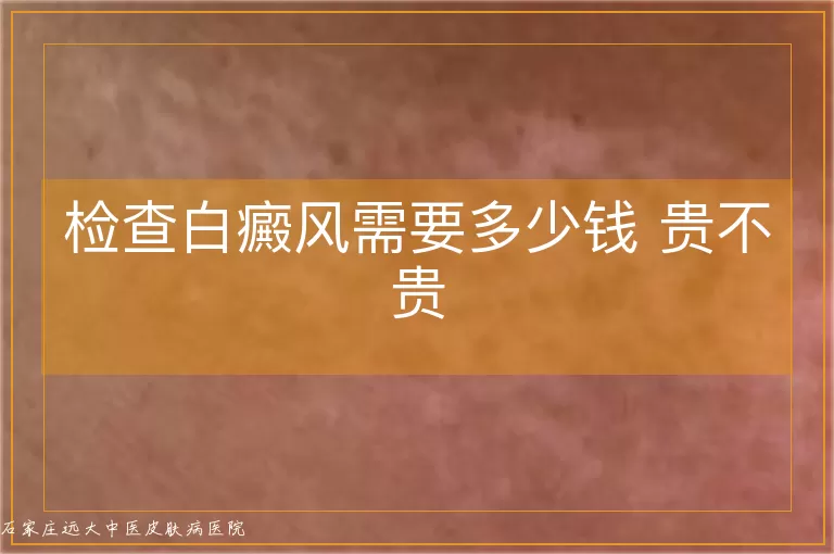 检查白癜风需要多少钱 贵不贵