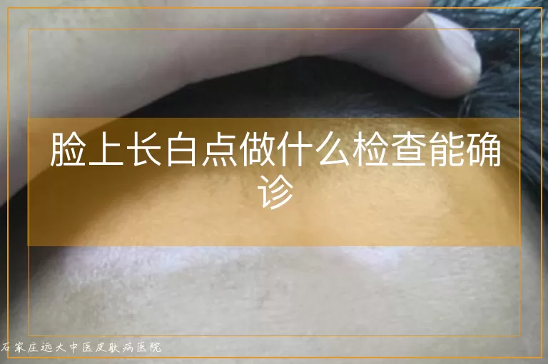 脸上长白点做什么检查能确诊