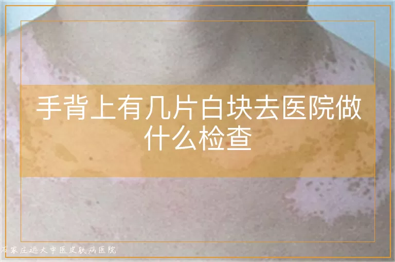 手背上有几片白块去医院做什么检查