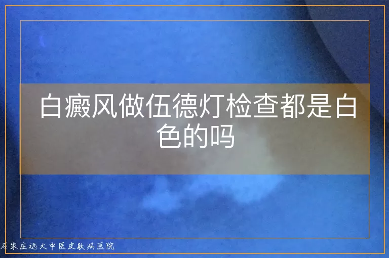 白癜风做伍德灯检查都是白色的吗