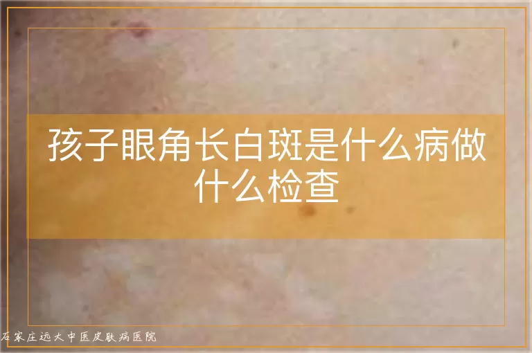 孩子眼角长白斑是什么病做什么检查