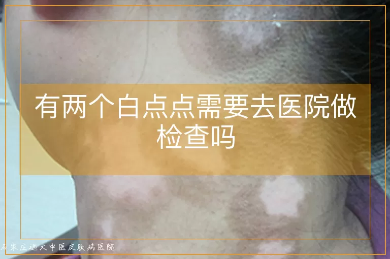 有两个白点点需要去医院做检查吗