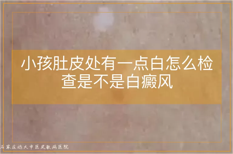 小孩肚皮处有一点白怎么检查是不是白癜风