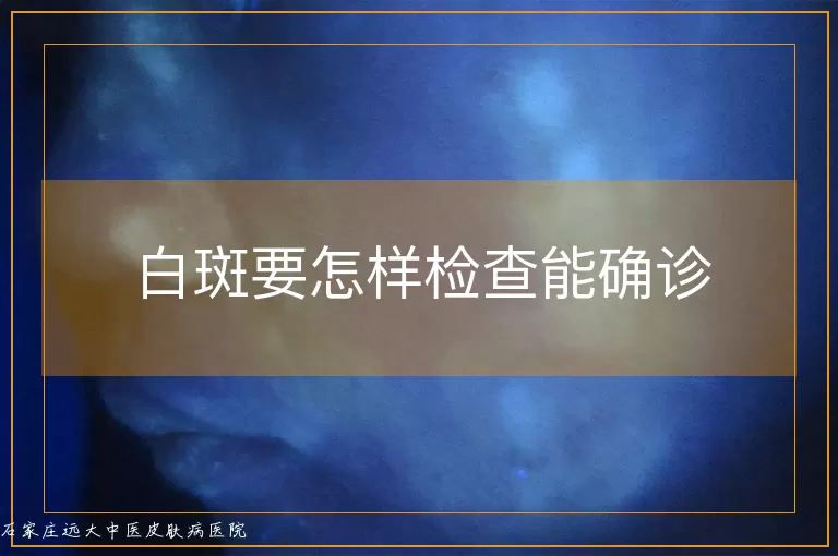 白斑要怎样检查能确诊