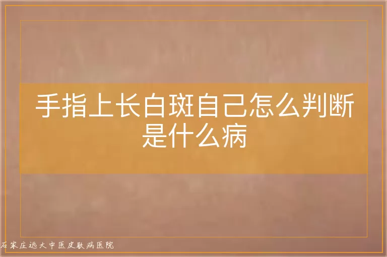 手指上长白斑自己怎么判断是什么病
