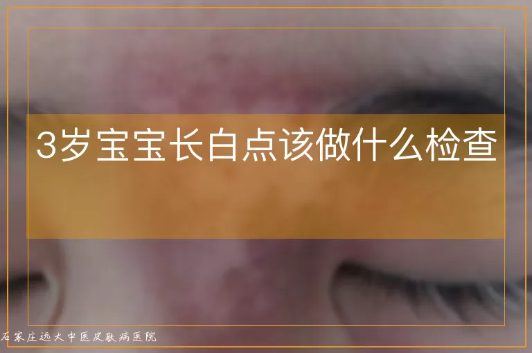 3岁宝宝长白点该做什么检查