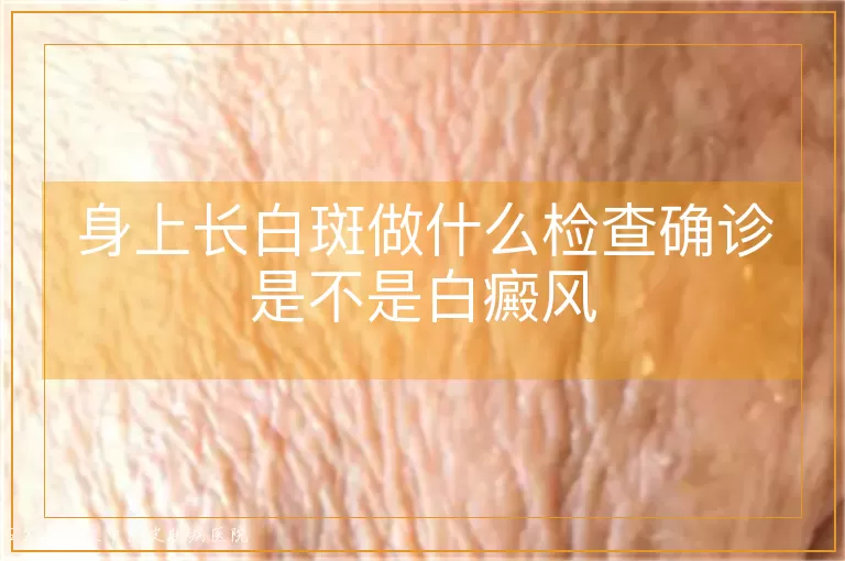 身上长白斑做什么检查确诊是不是白癜风