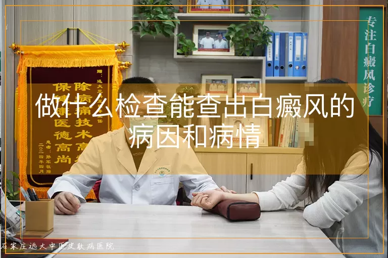 做什么检查能查出白癜风的病因和病情