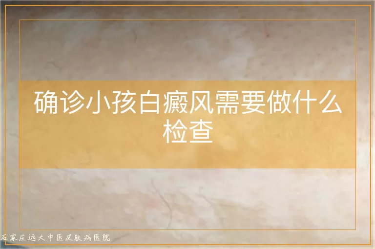 确诊小孩白癜风需要做什么检查