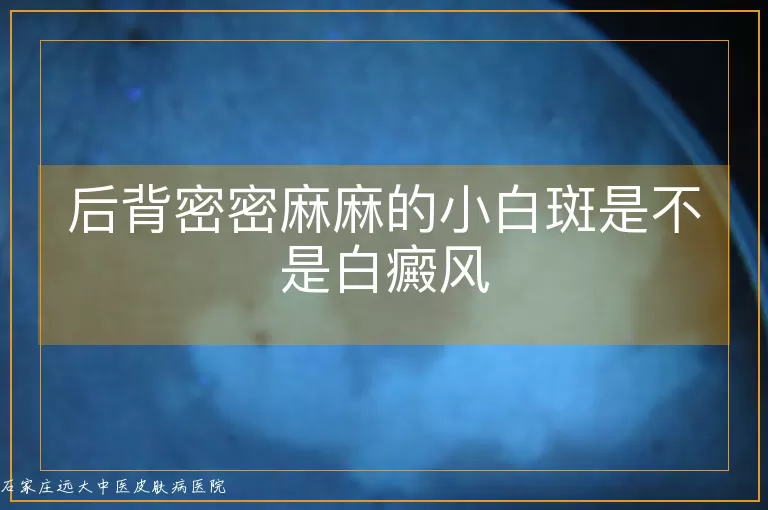后背密密麻麻的小白斑是不是白癜风