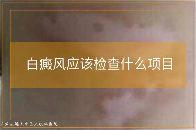 白癜风应该检查什么项目