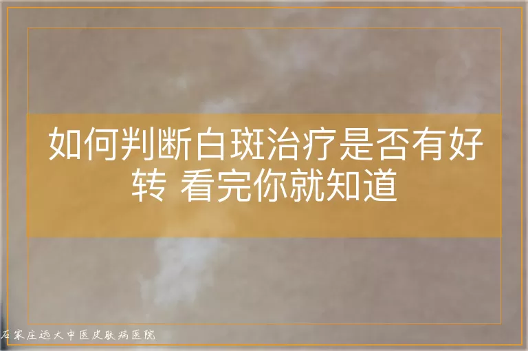 如何判断白斑治疗是否有好转 看完你就知道