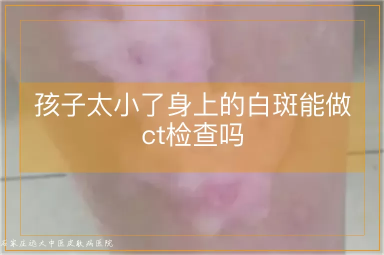 孩子太小了身上的白斑能做ct检查吗