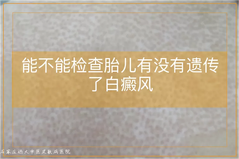 能不能检查胎儿有没有遗传了白癜风