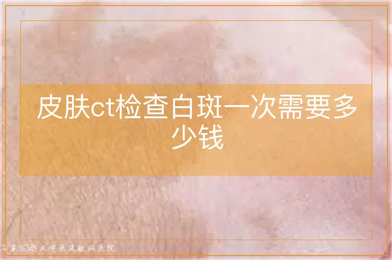 皮肤ct检查白斑一次需要多少钱