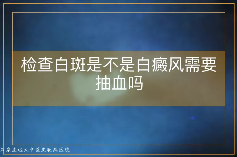 检查白斑是不是白癜风需要抽血吗