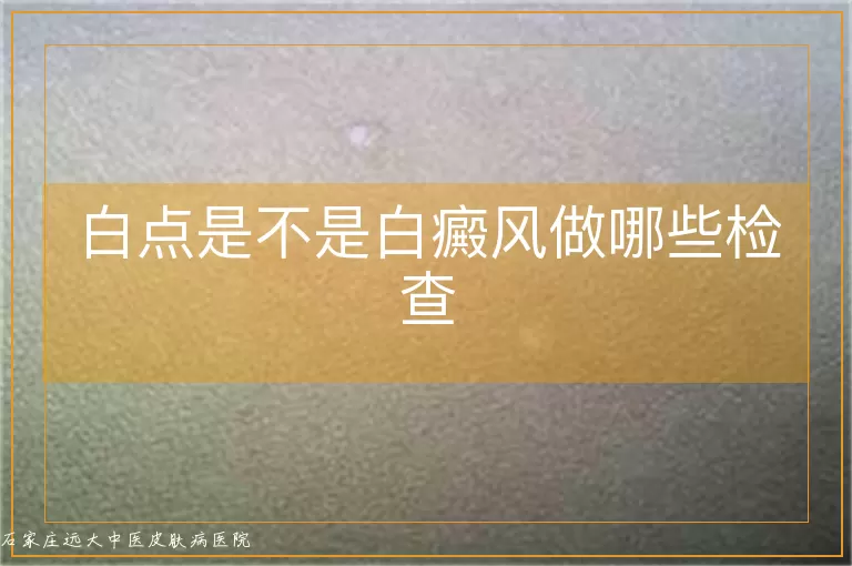 白点是不是白癜风做哪些检查