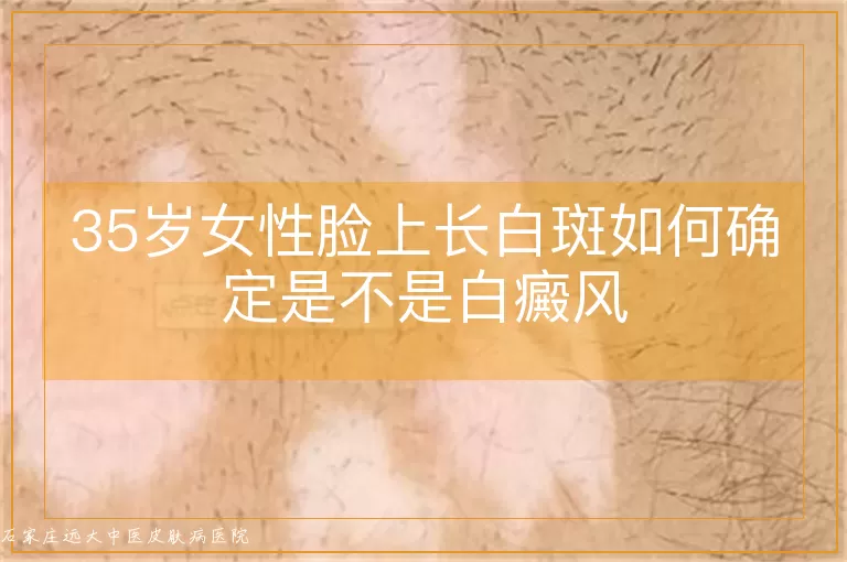 35岁女性脸上长白斑如何确定是不是白癜风