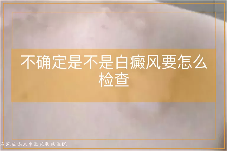 不确定是不是白癜风要怎么检查