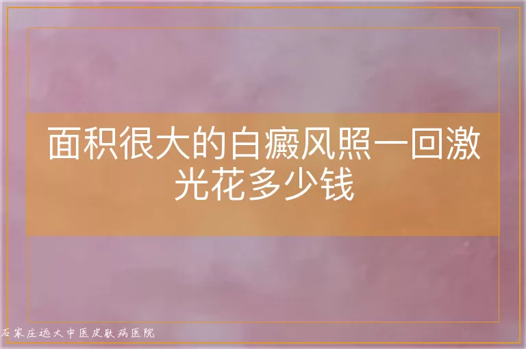 面积很大的白癜风照一回激光花多少钱