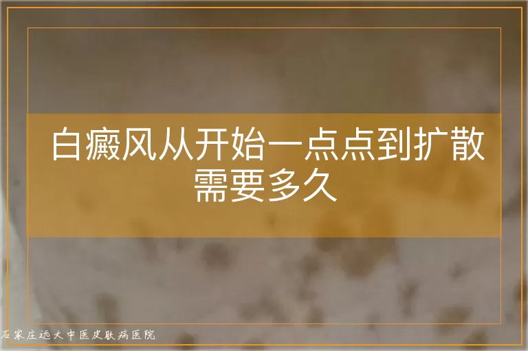 白癜风从开始一点点到扩散需要多久