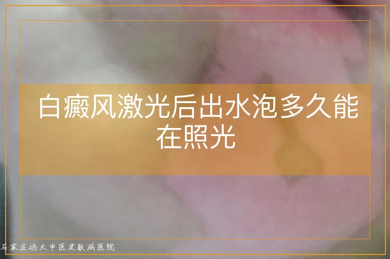 白癜风激光后出水泡多久能在照光