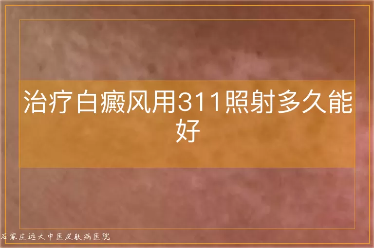 治疗白癜风用311照射多久能好