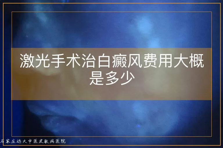激光手术治白癜风费用大概是多少