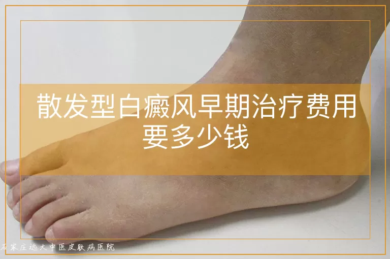 散发型白癜风早期治疗费用要多少钱