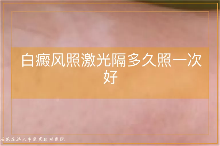 白癜风照激光隔多久照一次好