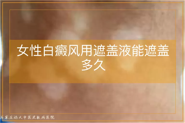 女性白癜风用遮盖液能遮盖多久
