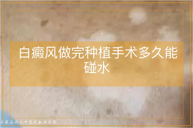 白癜风做完种植手术多久能碰水