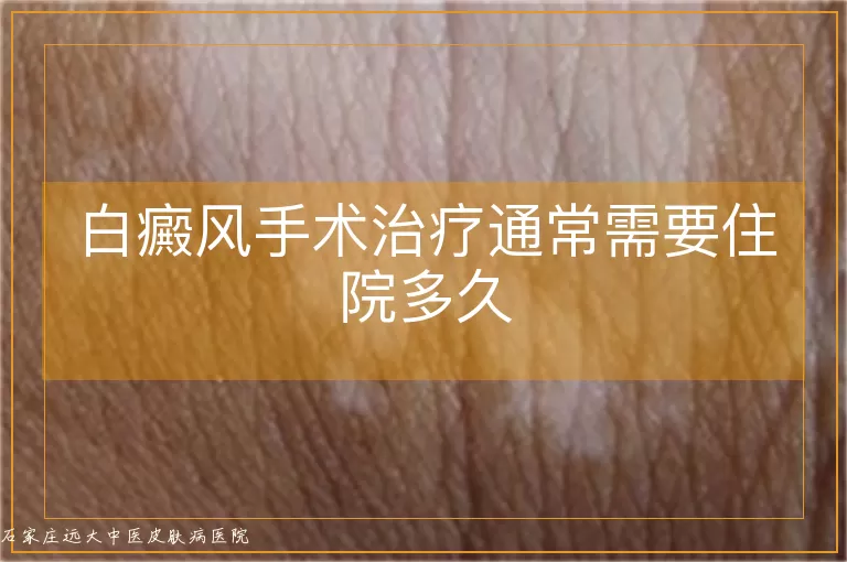 白癜风手术治疗通常需要住院多久