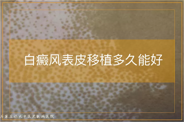 白癜风表皮移植多久能好