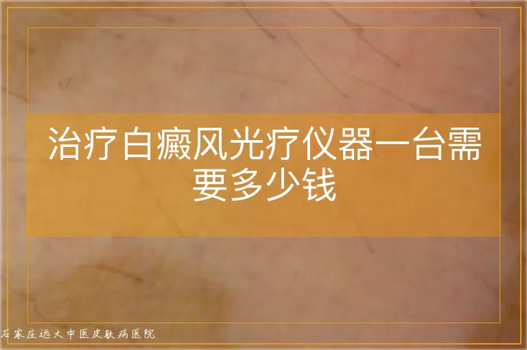 治疗白癜风光疗仪器一台需要多少钱