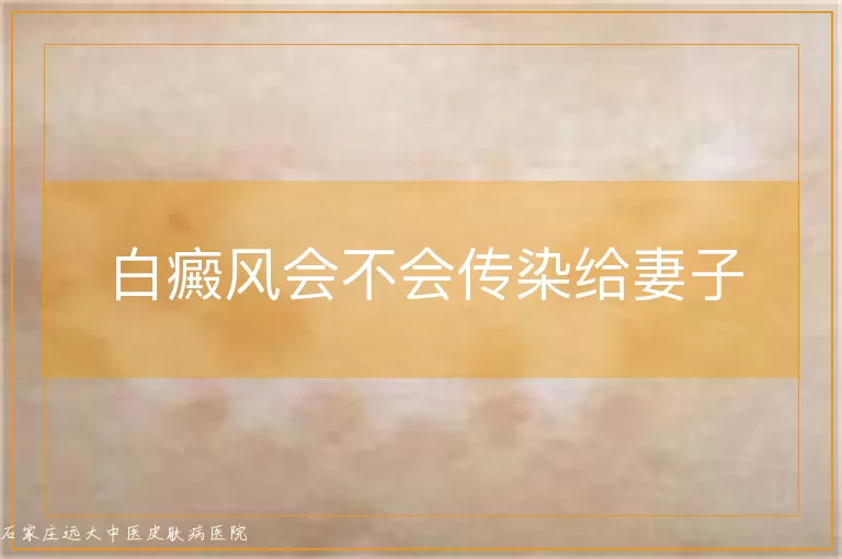 白癜风会不会传染给妻子