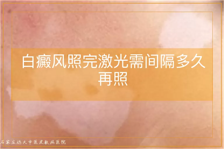 白癜风照完激光需间隔多久再照