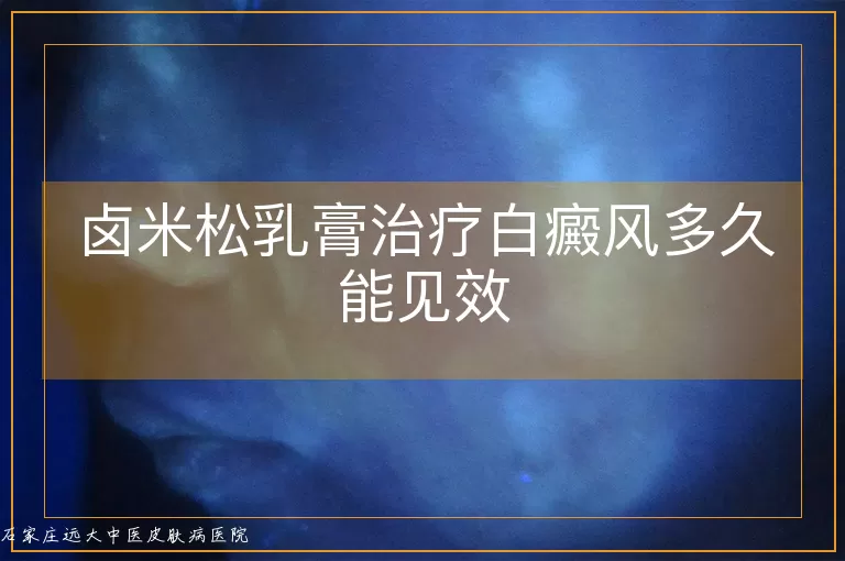 卤米松乳膏治疗白癜风多久能见效