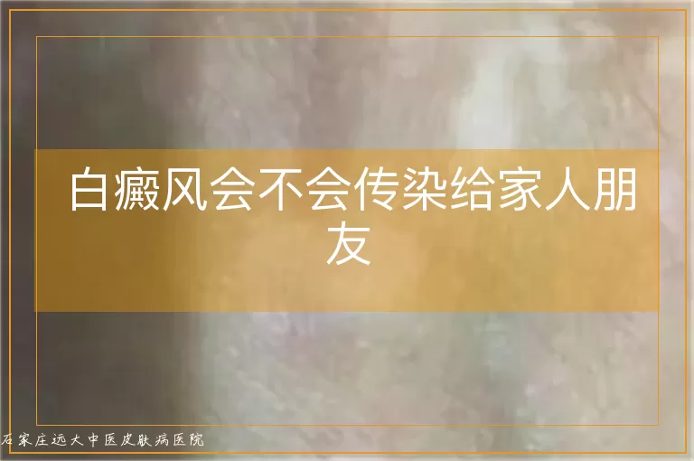 白癜风会不会传染给家人朋友
