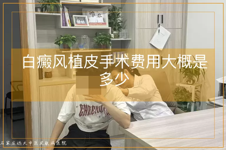 白癜风植皮手术费用大概是多少
