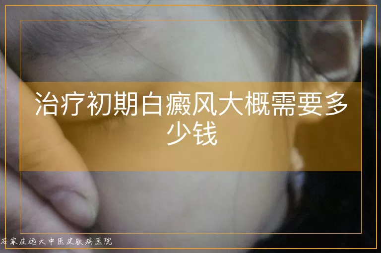 治疗初期白癜风大概需要多少钱